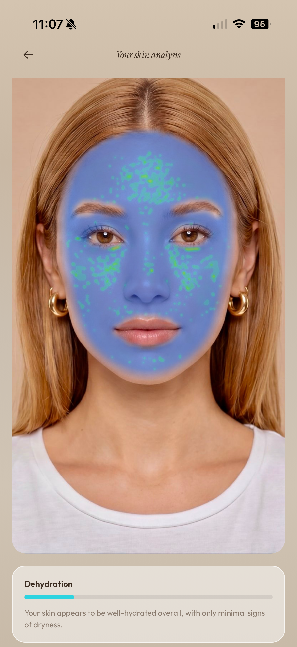 Real Face Scan result — dehydration